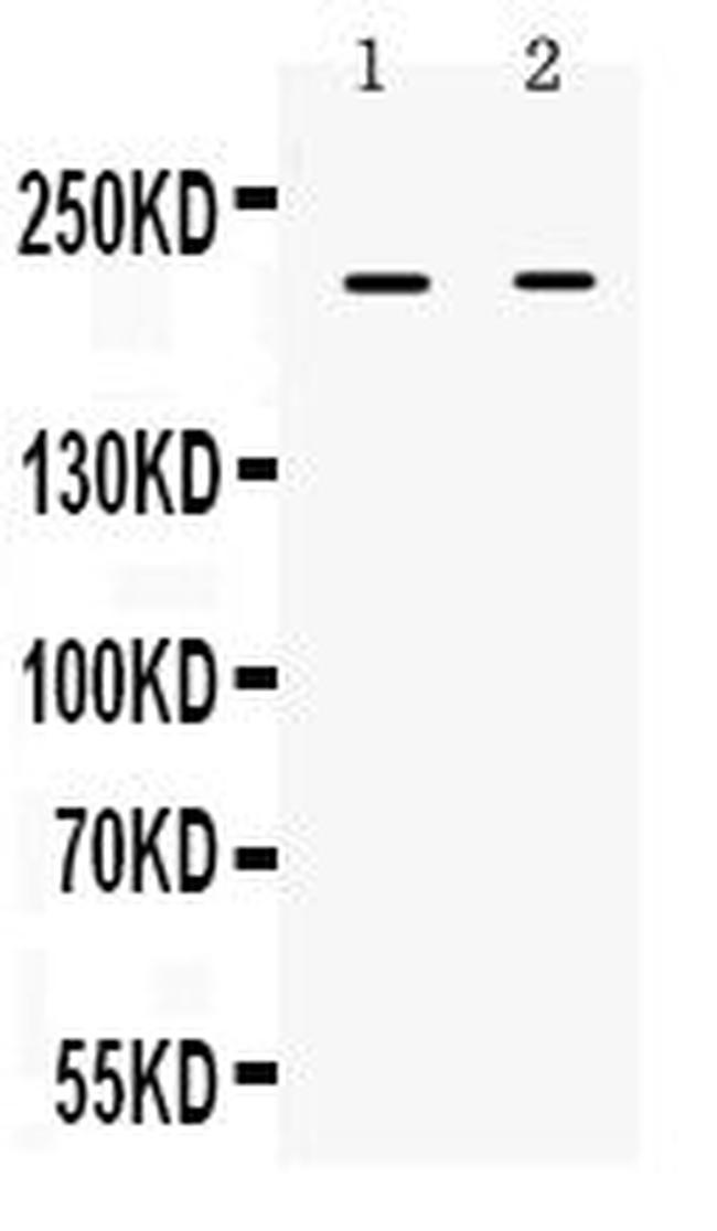 BRCA1 Antibody in Western Blot (WB)