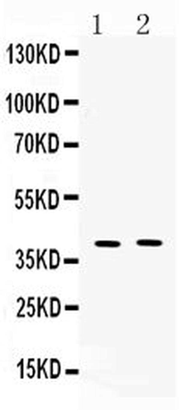 MC3R Antibody in Western Blot (WB)