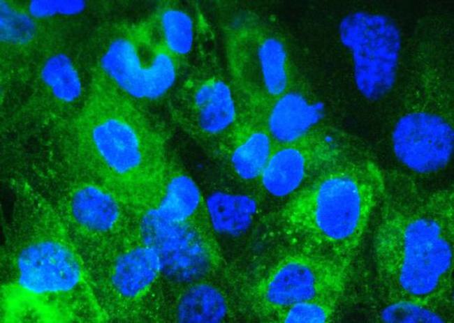 beta-2 Microglobulin Antibody in Immunocytochemistry (ICC/IF)