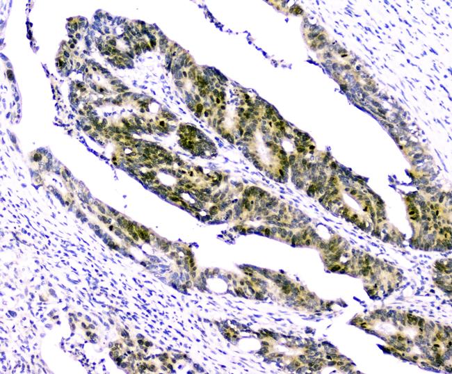 Survivin Antibody in Immunohistochemistry (Paraffin) (IHC (P))