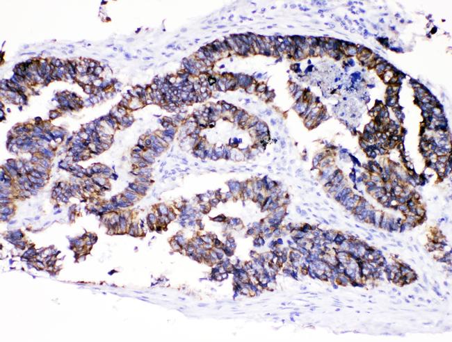 Cytokeratin 8 Antibody in Immunohistochemistry (Paraffin) (IHC (P))