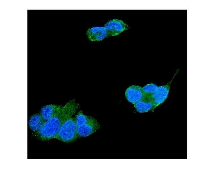 TIMP4 Antibody in Immunocytochemistry (ICC/IF)