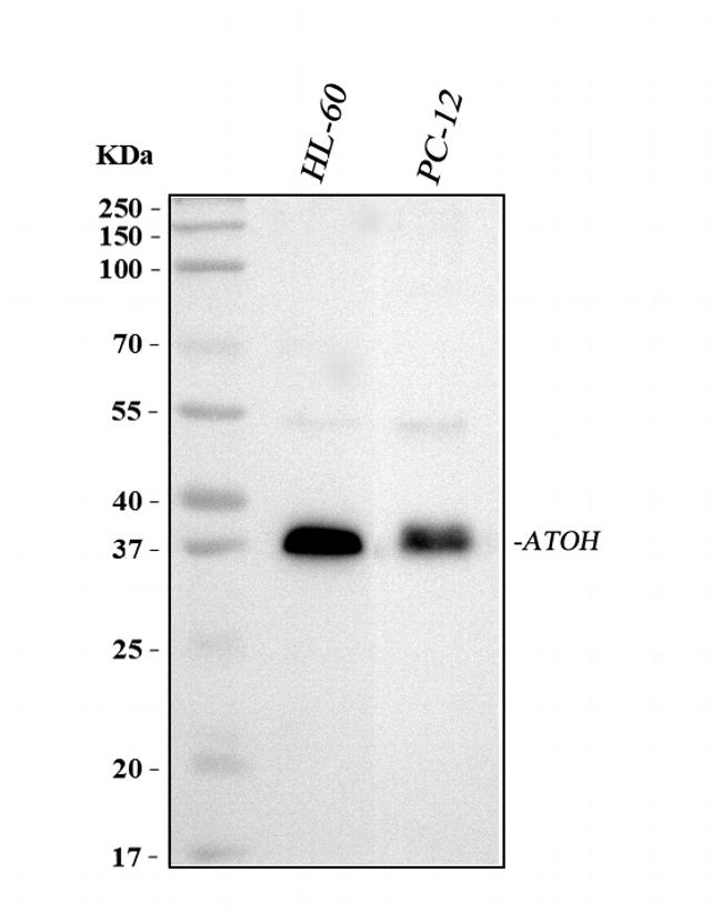 ATOH1 Antibody in Western Blot (WB)