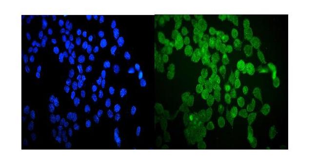 HSP20 Antibody in Immunocytochemistry (ICC/IF)