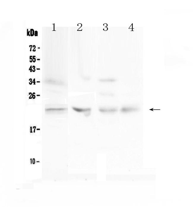 TIMP1 Antibody in Western Blot (WB)