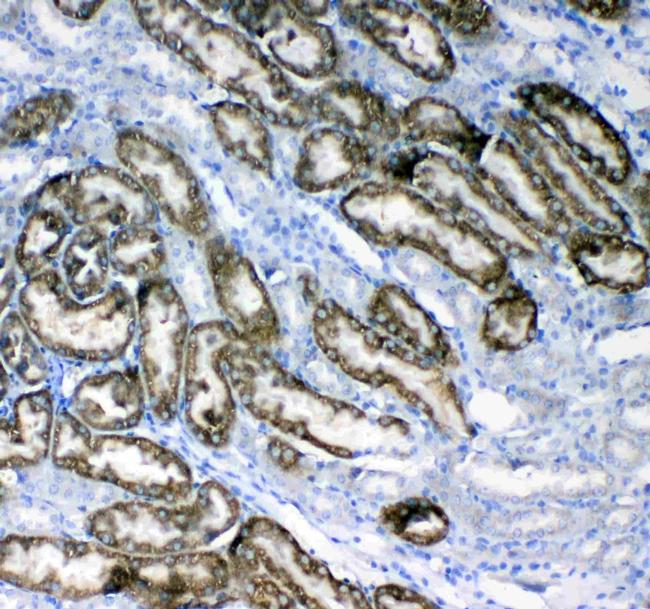 Glycerol kinase Antibody in Immunohistochemistry (Paraffin) (IHC (P))