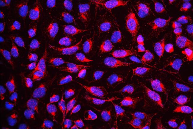 DYRK1A Antibody in Immunocytochemistry (ICC/IF)