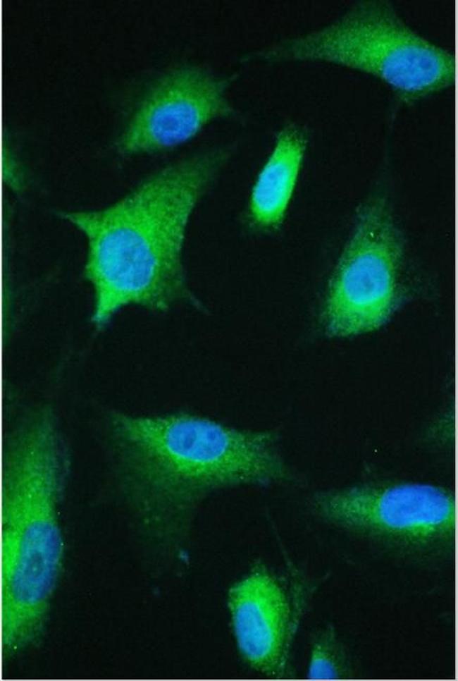 ESRRG Antibody in Immunocytochemistry (ICC/IF)