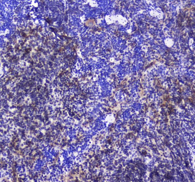 SHIP1 Antibody in Immunohistochemistry (Paraffin) (IHC (P))