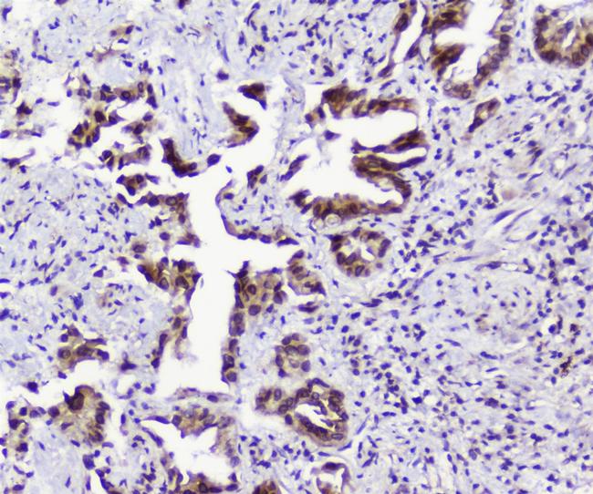 TPR Antibody in Immunohistochemistry (Paraffin) (IHC (P))