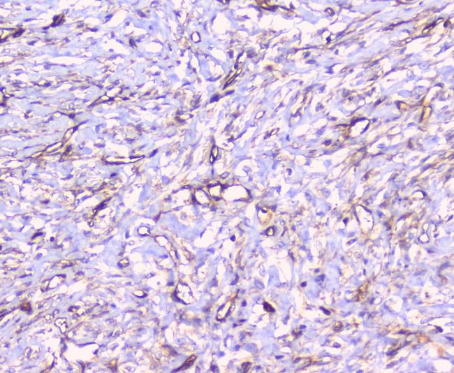 FCGR2A Antibody in Immunohistochemistry (Paraffin) (IHC (P))