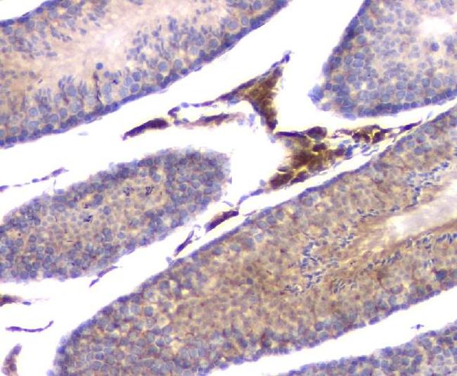 IFN gamma Antibody in Immunohistochemistry (Paraffin) (IHC (P))