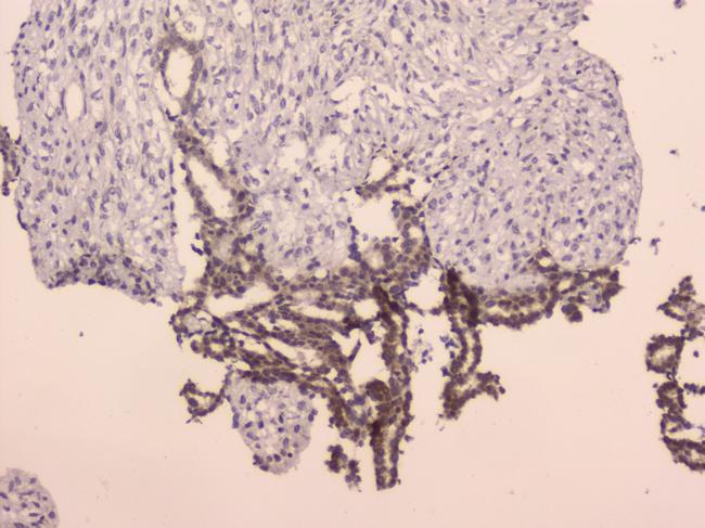 LRIG1 Antibody in Immunohistochemistry (Paraffin) (IHC (P))