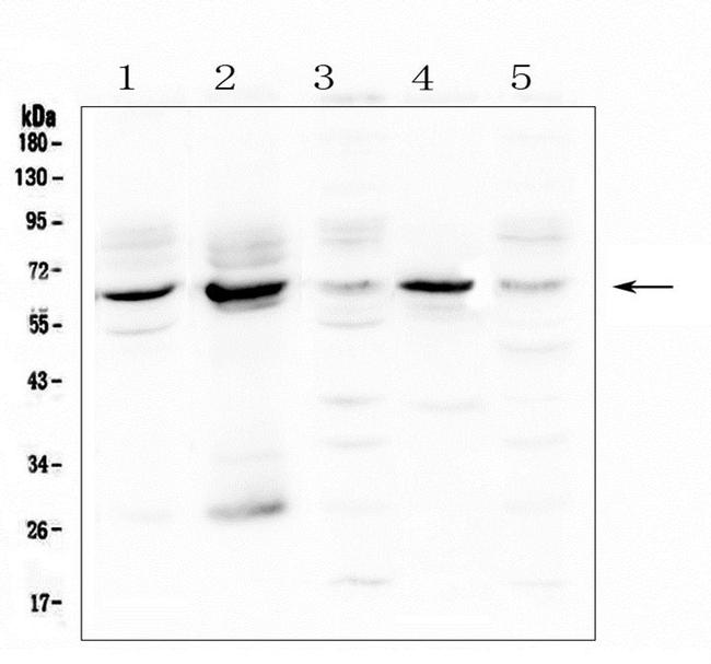 METTL3 Antibody in Western Blot (WB)