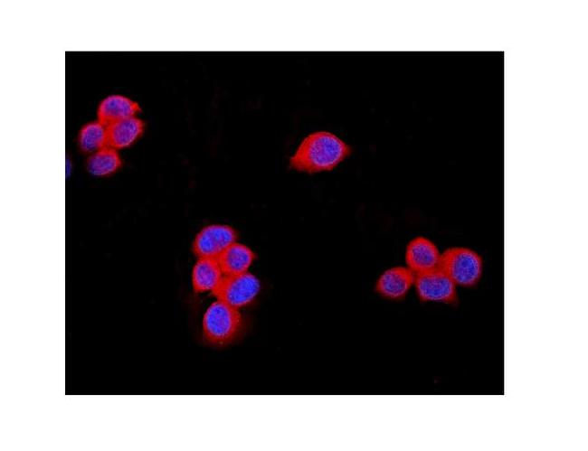 TRPM7 Antibody in Immunocytochemistry (ICC/IF)