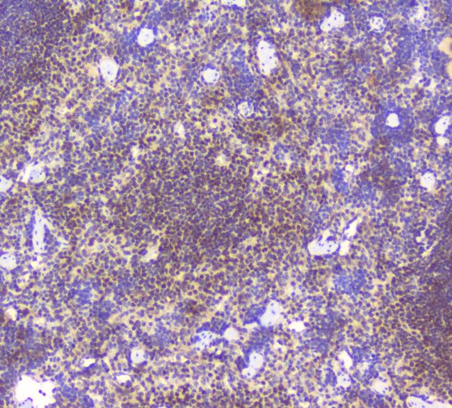 BCL6 Antibody in Immunohistochemistry (Paraffin) (IHC (P))