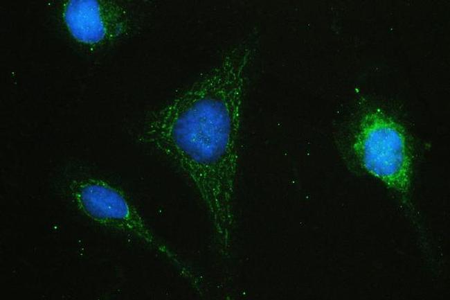 HAS1 Antibody in Immunocytochemistry (ICC/IF)