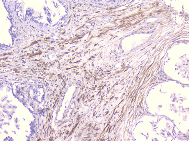 PCDH15 Antibody in Immunohistochemistry (Paraffin) (IHC (P))