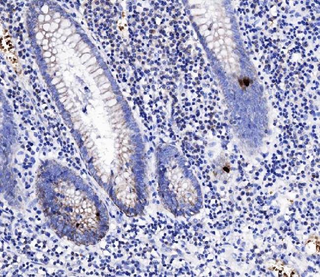 PYY Antibody in Immunohistochemistry (Paraffin) (IHC (P))