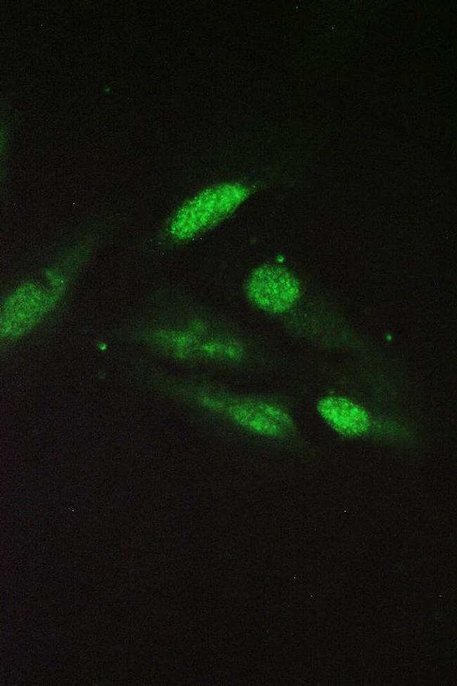 Sorcin Antibody in Immunocytochemistry (ICC/IF)