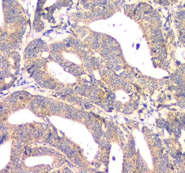 APRT Antibody in Immunohistochemistry (Paraffin) (IHC (P))