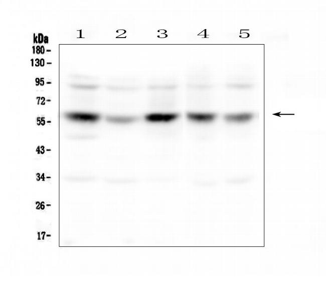 CDK8 Antibody in Western Blot (WB)