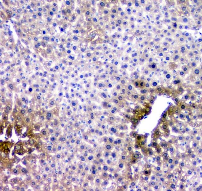 RMI2 Antibody in Immunohistochemistry (Paraffin) (IHC (P))