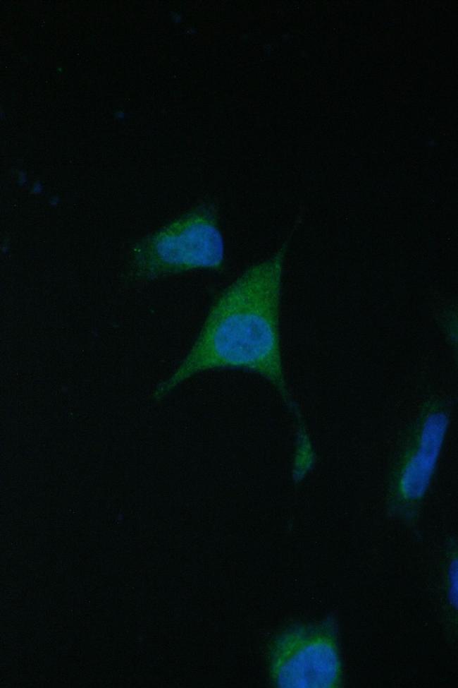 TIM17 Antibody in Immunocytochemistry (ICC/IF)