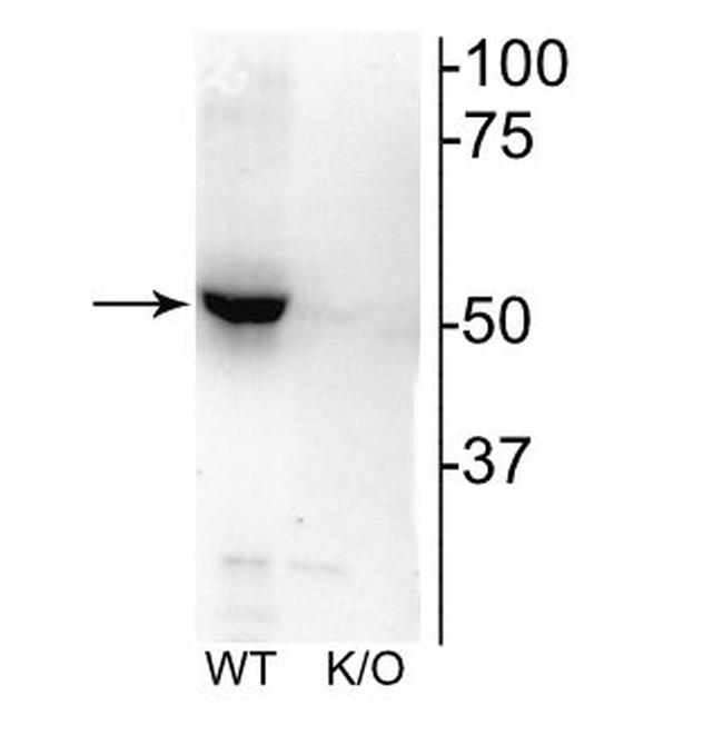 CHRNB2 Antibody in Western Blot (WB)