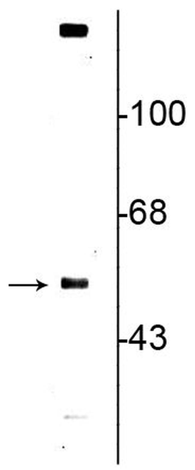 VMAT2 Antibody in Western Blot (WB)