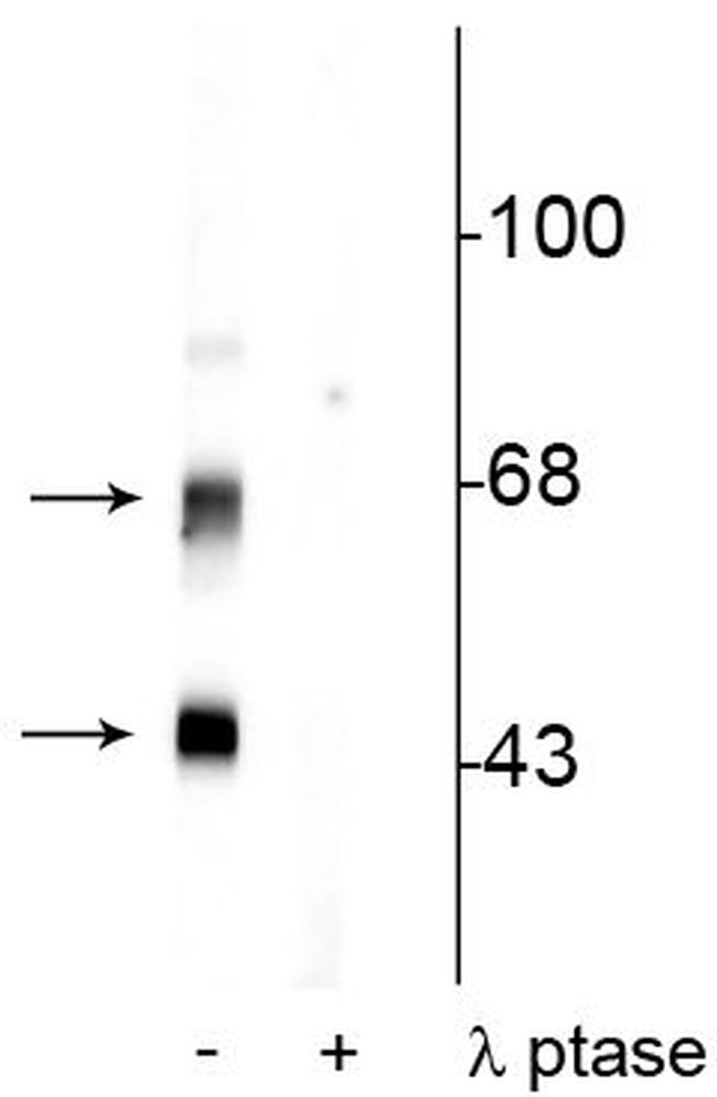 Phospho-CaMKII alpha/beta (Thr306) Antibody in Western Blot (WB)