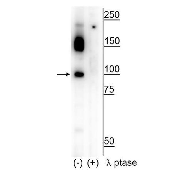 Phospho-CtIP (Ser326) Antibody in Western Blot (WB)