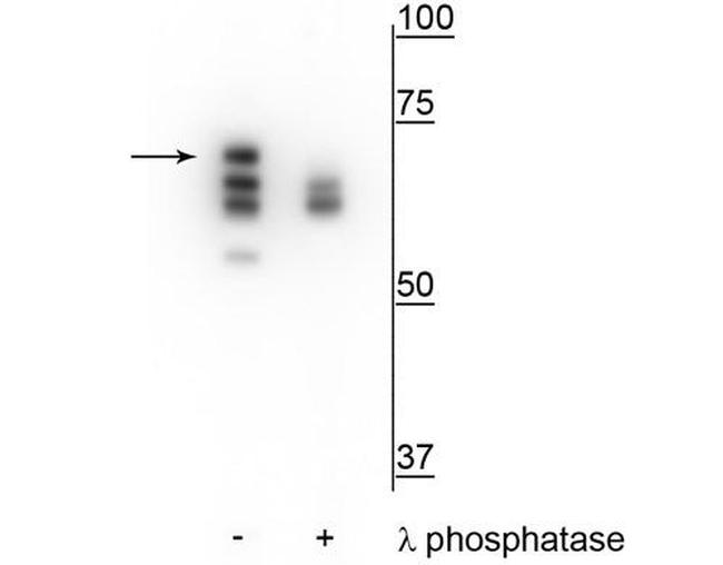 Phospho-HSP70 (Ser153) Antibody in Western Blot (WB)