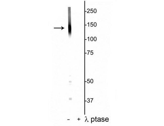 Phospho-KCC2 (Thr1007) Antibody in Western Blot (WB)