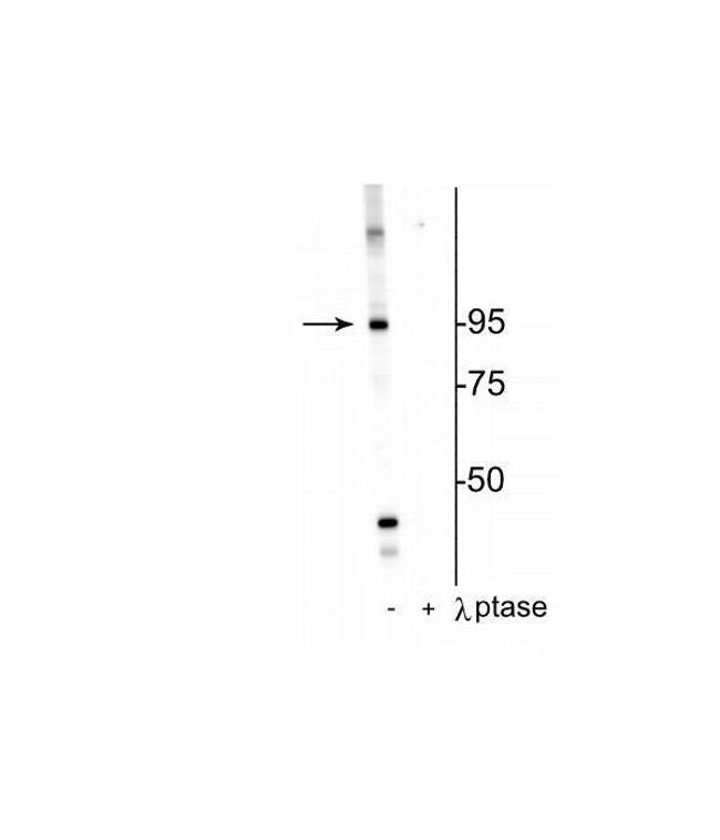 Phospho-INSR (Thr1160) Antibody in Western Blot (WB)