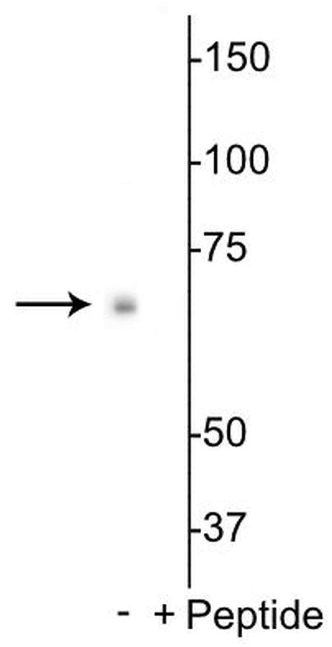 Phospho-p70 S6 Kinase (Ser398) Antibody in Western Blot (WB)