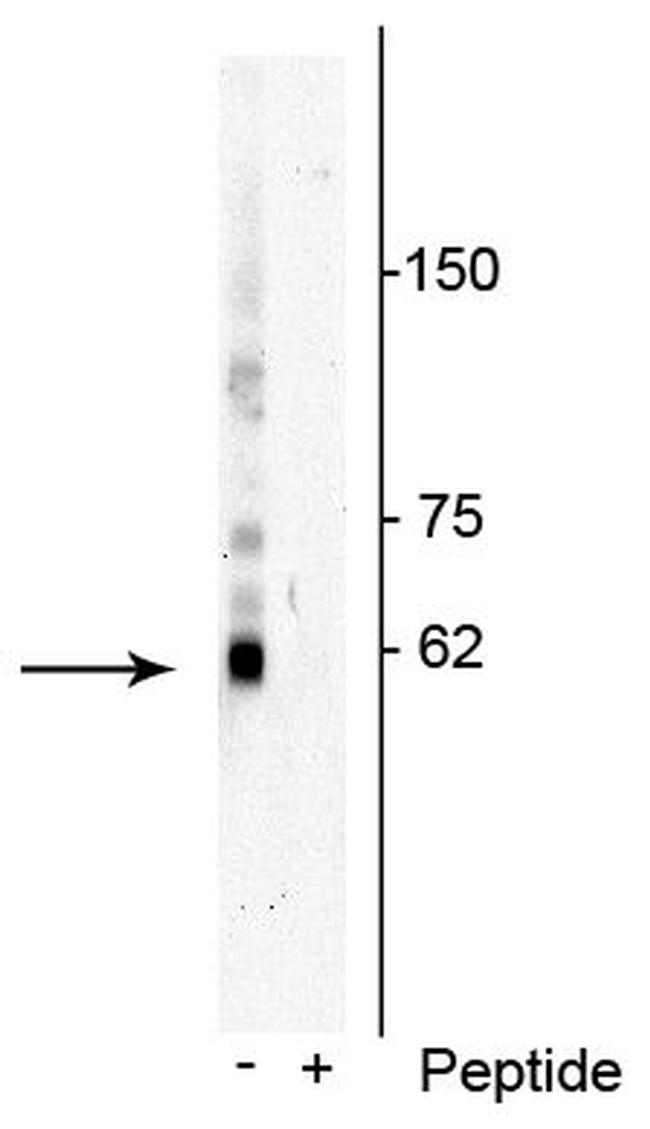 Phospho-SQSTM1 (Thr269, Ser272) Antibody in Western Blot (WB)