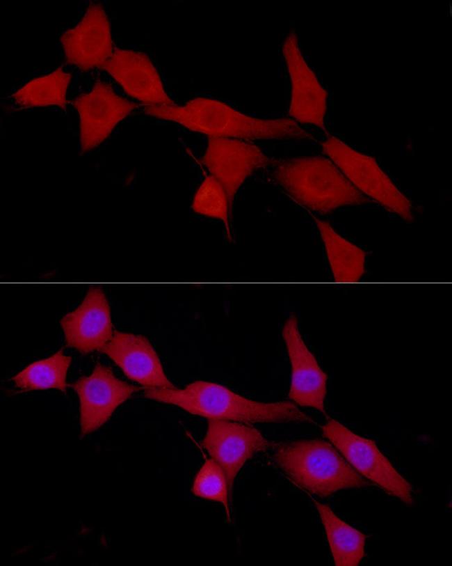 CAB39 Antibody in Immunocytochemistry (ICC/IF)