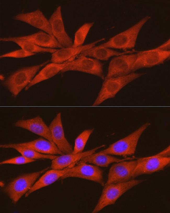 CK2 alpha-2 Antibody in Immunocytochemistry (ICC/IF)