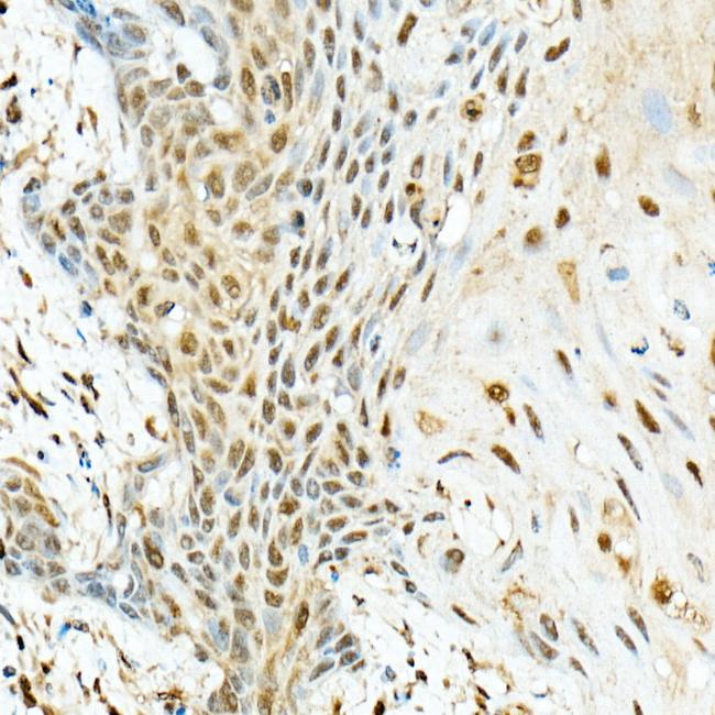 KIAA1429 Antibody in Immunohistochemistry (Paraffin) (IHC (P))