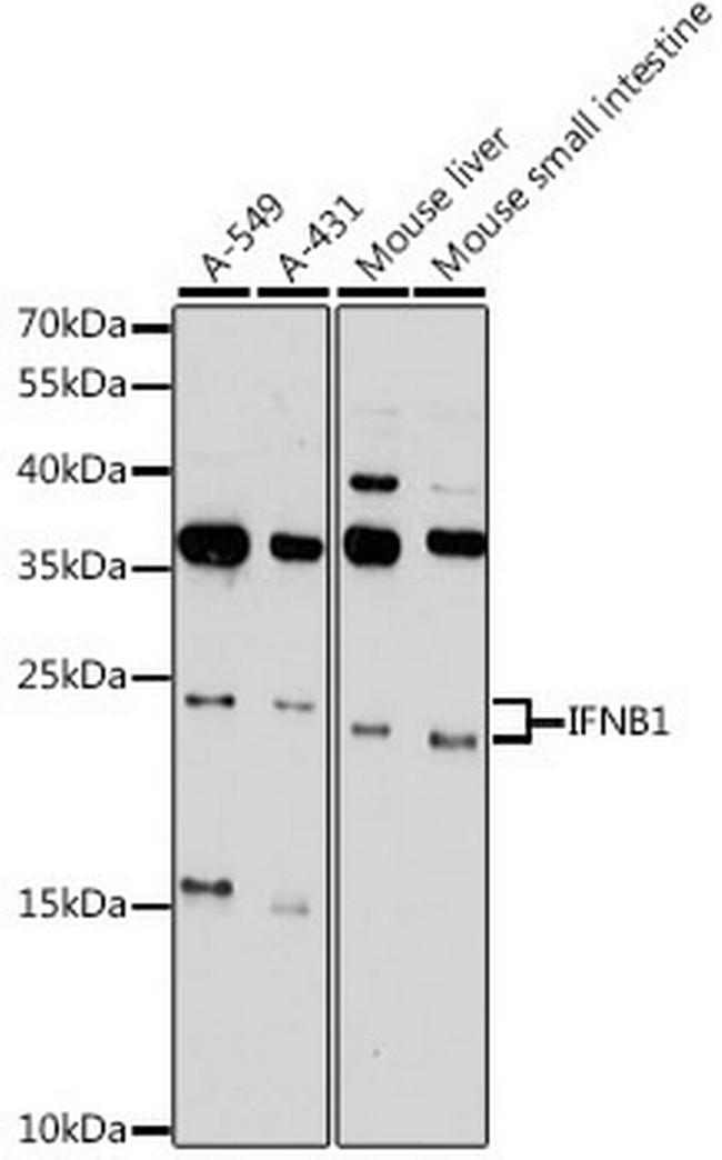 IFN beta Antibody in Western Blot (WB)