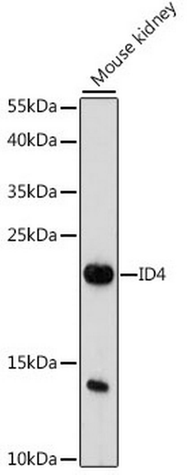 ID4 Antibody in Western Blot (WB)