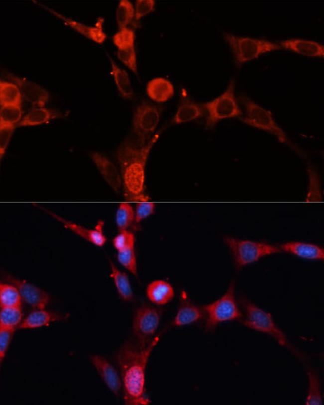 ASM Antibody in Immunocytochemistry (ICC/IF)