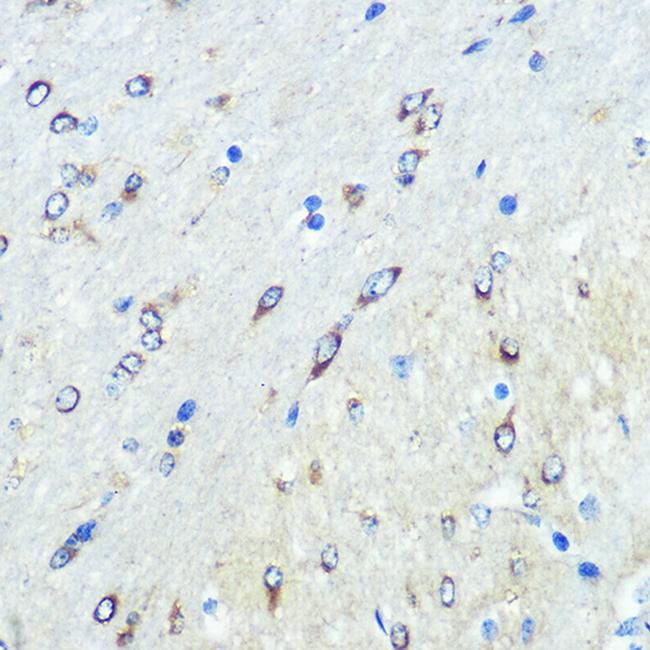 FUT4 Antibody in Immunohistochemistry (Paraffin) (IHC (P))