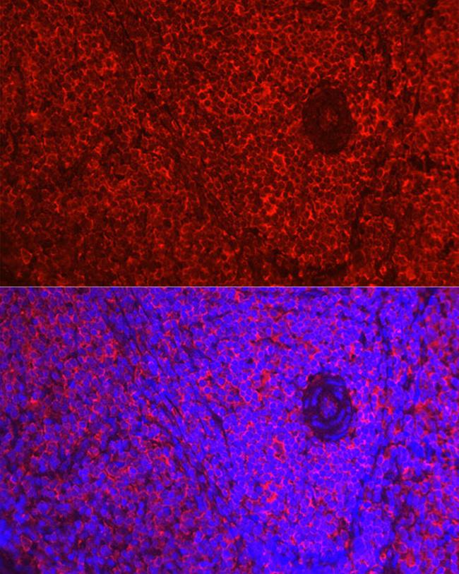 beta-1 Adrenergic Receptor Antibody in Immunohistochemistry (Paraffin) (IHC (P))