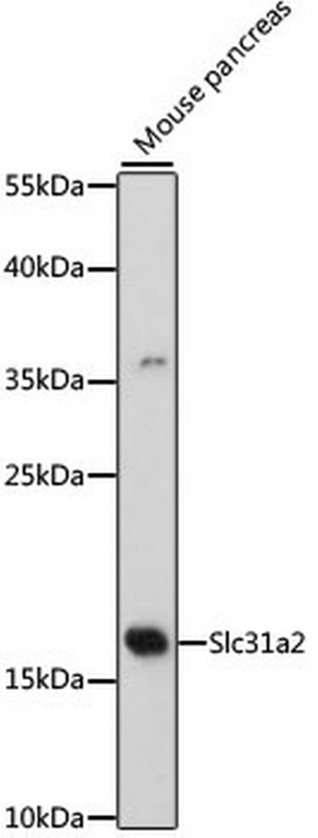 CTR2 Antibody in Western Blot (WB)