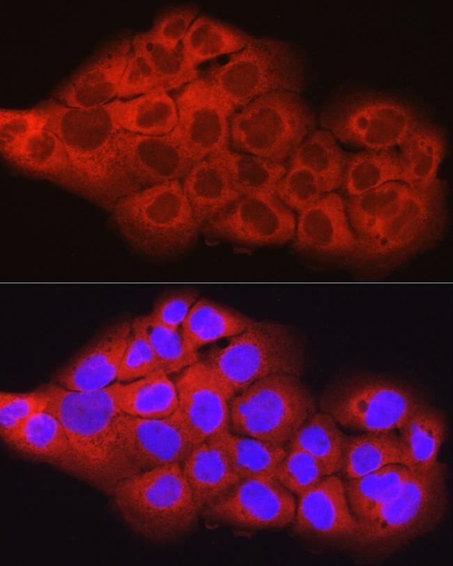 SCD Antibody in Immunocytochemistry (ICC/IF)