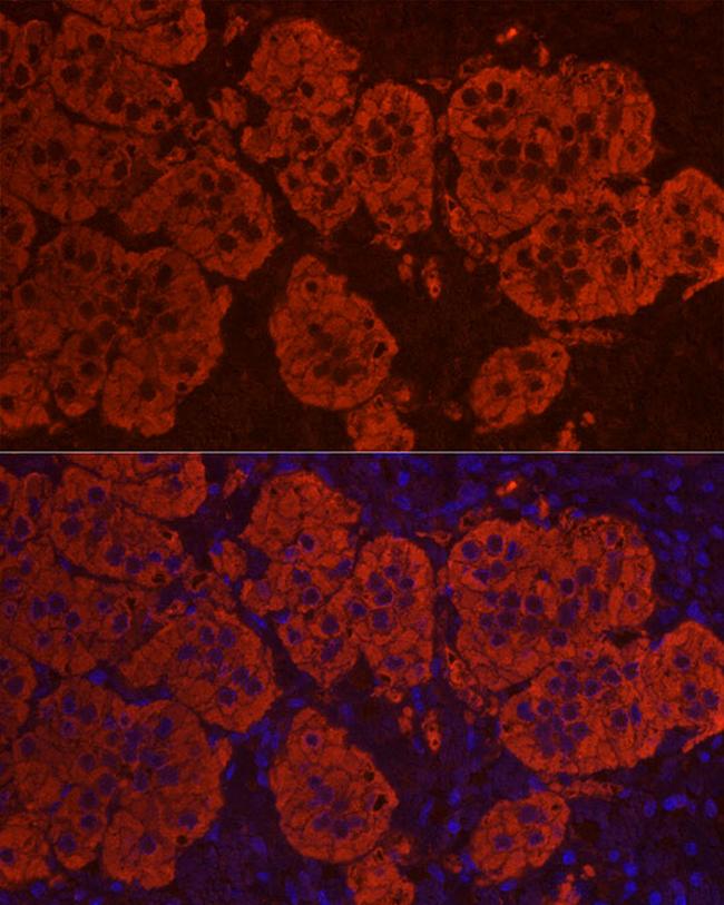 STAR Antibody in Immunocytochemistry (ICC/IF)