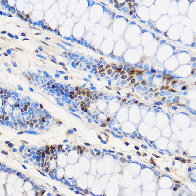 ZNF263 Antibody in Immunohistochemistry (Paraffin) (IHC (P))