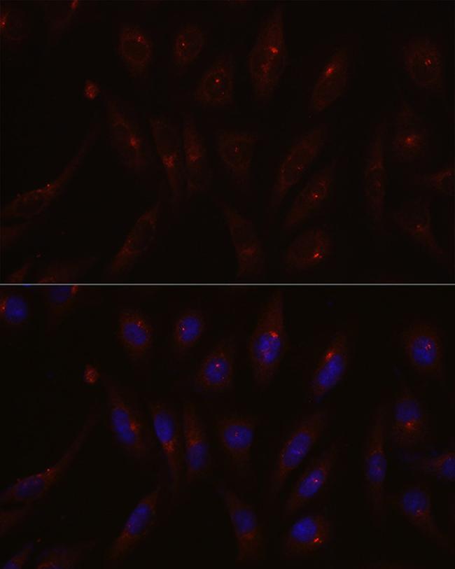 PCM1 Antibody in Immunocytochemistry (ICC/IF)